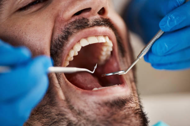 Best Emergency Tooth Extraction in Orwell, OH